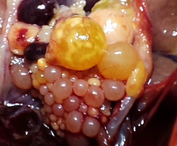 Petetüsző elfajulás